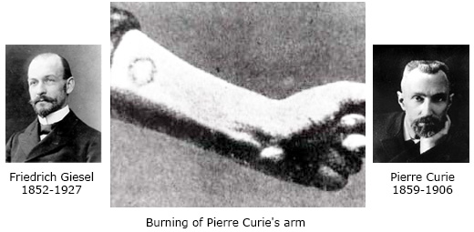 Picture of Pierre Curie's arm burned by radium exposition
